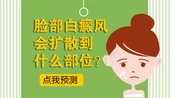 小孩身上发现米粒大白斑只照uvb光能控制住吗