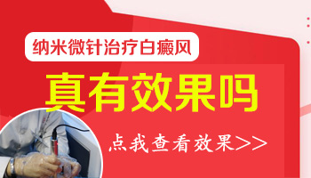 小孩身上有一片白只吃药不照光能好吗
