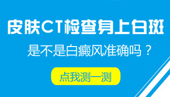孩子身上有片白什么情况 如何治疗