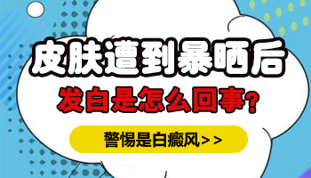 儿童后背有片白进口308激光怎么治疗