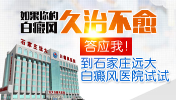 儿童腹部长白癜风怎么治疗科学