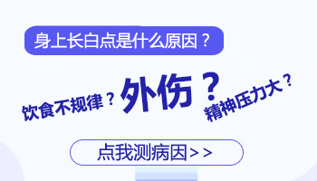 小孩身上有白点抹药膏效果怎么样