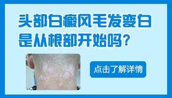 孩子身上出现小白块擦他克莫司能好吗