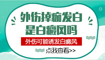 发展期白癜风吃药控制不住怎么治疗能行