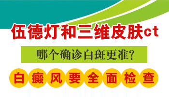 儿童腹部有白点抹他克莫司多久能好