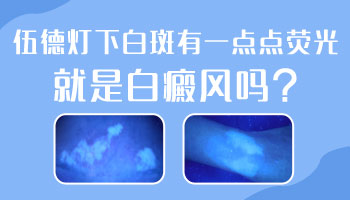 婴儿身上长黄豆大白斑抹他克莫司多久能好