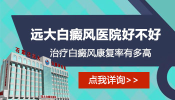 白癜风处在发展期怎么控制，哪种方法效果好