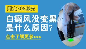 儿童头部长白癜风照激光一次需要多久