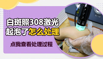 孩子身上有白斑抹药膏效果怎么样