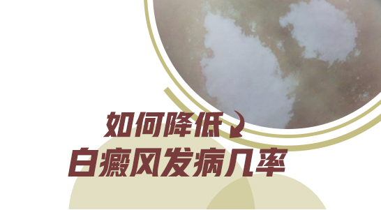 小孩身上有大面积白斑照308激光2次不见效怎么办