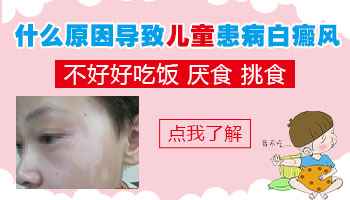 小孩身上有鸡蛋大白斑怎么治疗正规