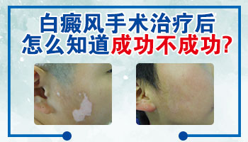 婴儿身上发现米粒大白斑怎么治疗 有康复案例吗