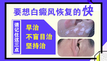 婴儿身上有鸡蛋大白斑做308激光照多长时间最佳