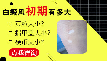 小孩身上有一片白什么情况 如何治疗