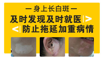 小孩身上突然白一块照308好还是uvb效果好