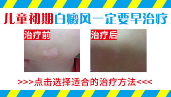 婴儿身上突然白一块进口308激光怎么治疗