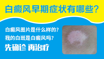小孩身上长白点做308激光照多长时间最佳