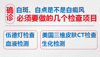 小孩身上长小白块照308激光多长久有好转