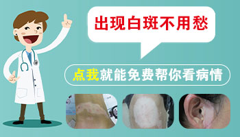 婴儿身上有白点抹他克莫司多久能好