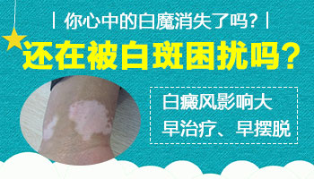 婴儿身上有鸡蛋大白斑做308激光照多长时间最佳