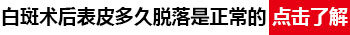 小孩身上有黄豆大白癜风照308激光2次不见效怎么办