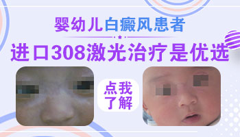 孩子身上长黄豆大白斑照UVB能治得好吗