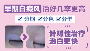 小孩身上出白块一直扩散用什么方法控制